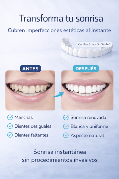 CARILLAS DENTALES SNAP-ON SMILE™