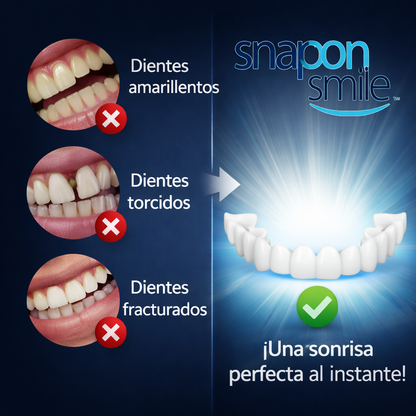 CARILLAS DENTALES SNAP-ON SMILE™
